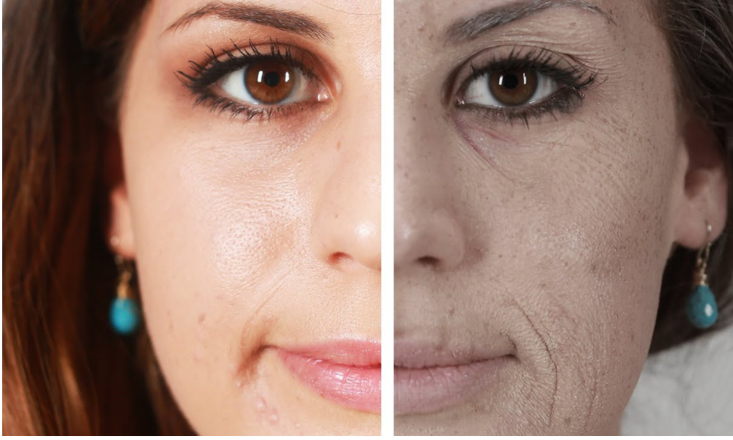 Teint terne
Un teint terne manque d’éclat et paraît fatigué ou sans vitalité, souvent causé par stress, âge ou déshydratation.
    En savoir plus