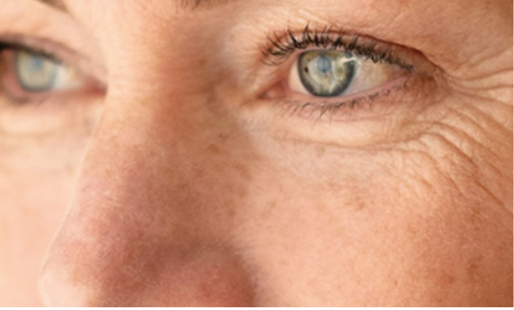 Rides et ridules
Venus Versa™ Pro lisse rides, raffermit la peau et stimule le collagène sans chirurgie invasive.
    En savoir plus