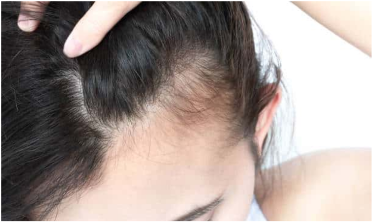 Perte de cheveux
Mésothérapie et microneedling stimulent la repousse, freinent la chute et densifient les cheveux naturellement.
    En savoir plus