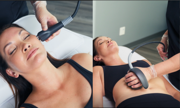 Radiofréquence multipolaire
Technologie non invasive qui raffermit la peau, réduit rides et cellulite en stimulant le collagène, sans douleur ni arrêt.
   En savoir plus