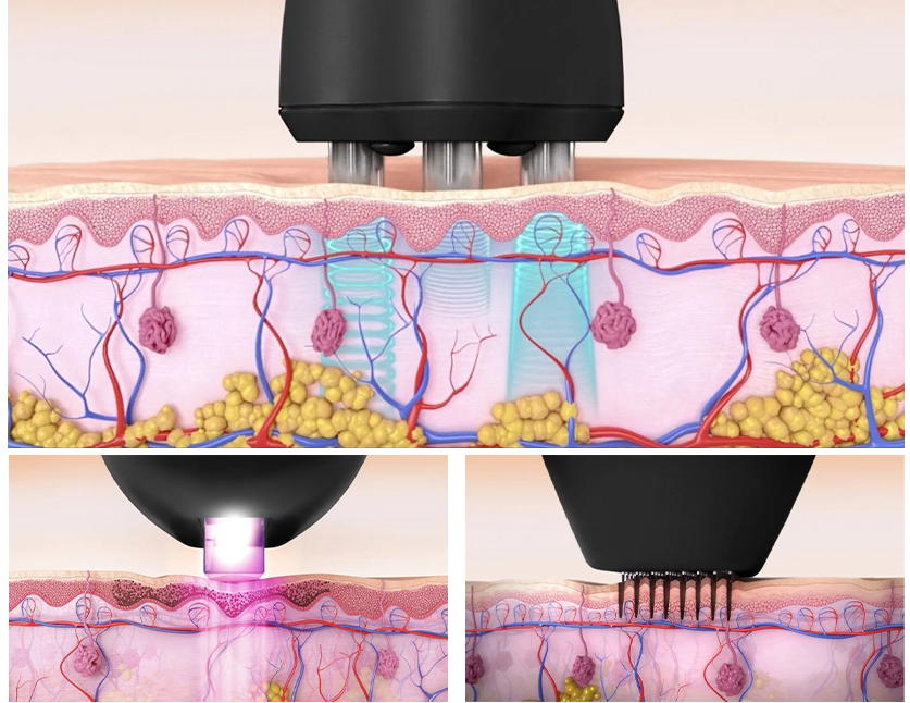 Photo_2eme_section Photo_2eme_section