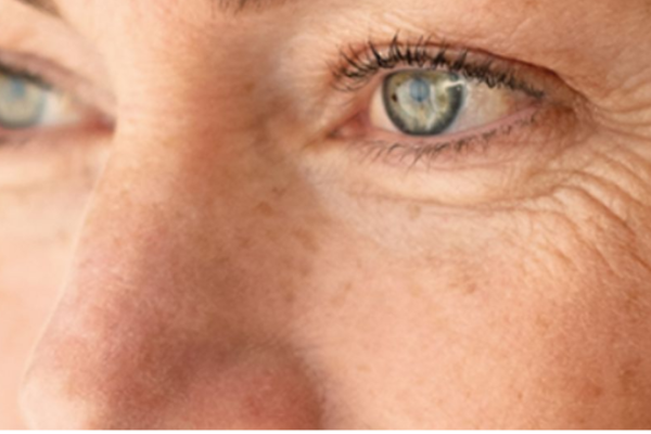 Rides et ridules

Venus Versa™ Pro lisse rides, raffermit la peau et stimule le collagène sans chirurgie invasive.

    En savoir plus