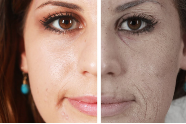 Dull Complexion
A dull complexion lacks radiance and may appear tired or lifeless, often caused by stress, aging, or dehydration.
Learn More